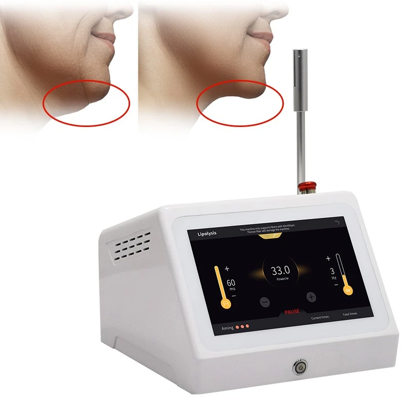 980nm 1470nm 635nm Endolift Laser Machine high quality